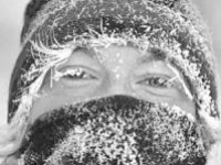 Что делать при обморожении